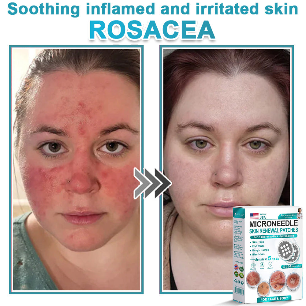 Congratulations! You’re our 500th customer today, and you get to enjoy a special offer: a second product for 88%off!𝐇𝐢𝐬𝐤𝐢𝐧®