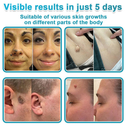 Congratulations! You’re our 500th customer today, and you get to enjoy a special offer: a second product for 88%off!𝐇𝐢𝐬𝐤𝐢𝐧®