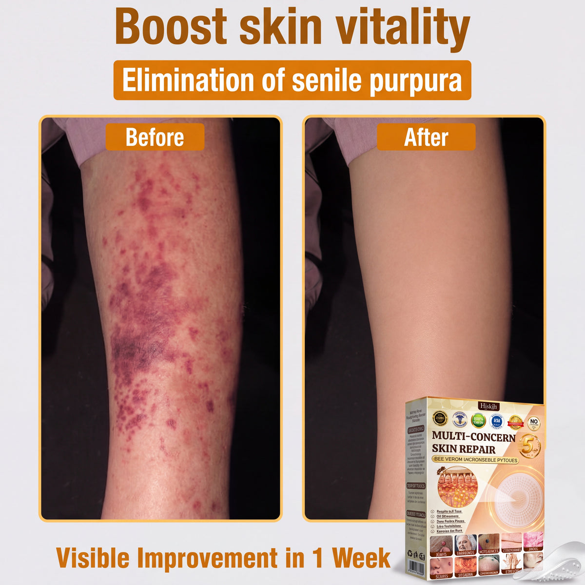 ✨Hiskin ®MULTI-CONCERN SKIN REPAIR BEE VENOM MICRONEEDLE PATCHES
