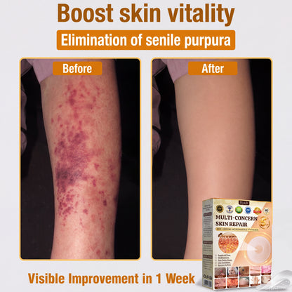 ✨Hiskin ®MULTI-CONCERN SKIN REPAIR BEE VENOM MICRONEEDLE PATCHES